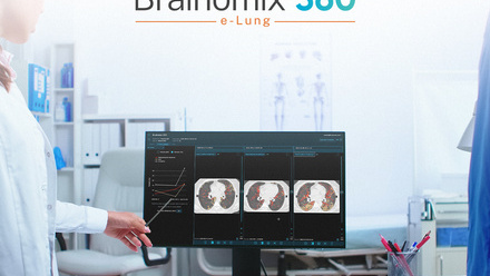 e-Lung+in+Clinical+Setting.jpg