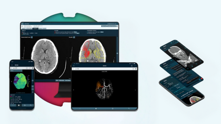 Brainomix.png