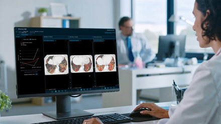 Physician+e-Lung+Image.jpg