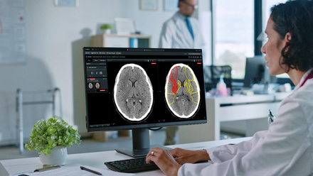 Brainomix+360+Stroke+provides+real-time+interpretation+of+brain+scans+to+help+guide+treatment+and+transfer+decisions+for+stroke+patients.jpg