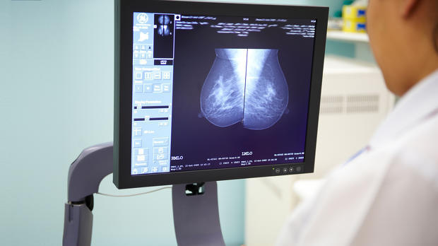 mammogram_breast_screening_nurse-hero.jpg