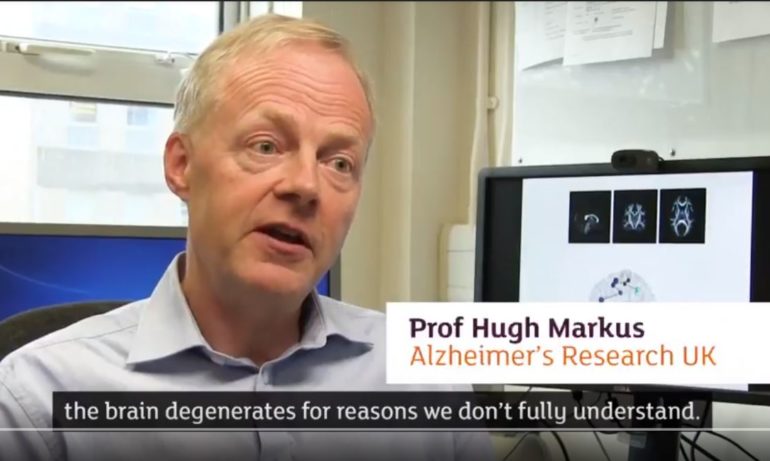 Testing new treatments for vascular dementia | Prof Hugh Markus | Alzheimer's Research UK